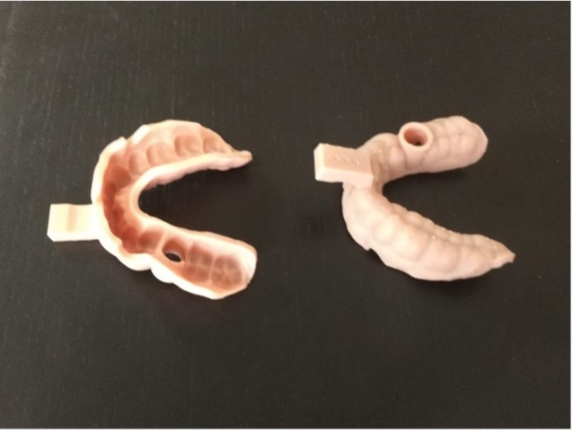 3D Dental Printing Limburg | Levertijd
