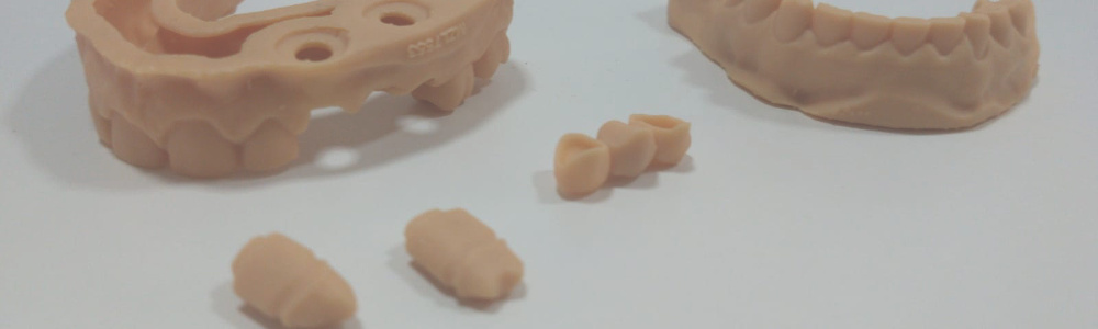 Dental Werkmodellen | 3D Printing Limburg